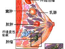 卵巢囊肿与月经周期有关吗