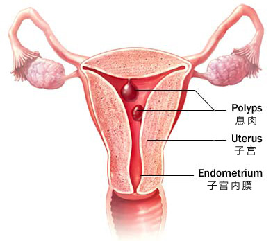 孕妇患宫颈息肉会对胎儿造成影响吗