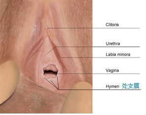 人造处女膜 还给了我丢失的幸福