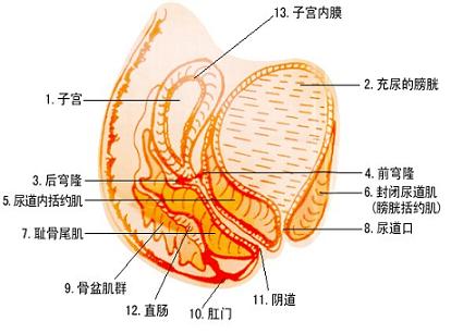 预防慢性盆腔炎要注意什么